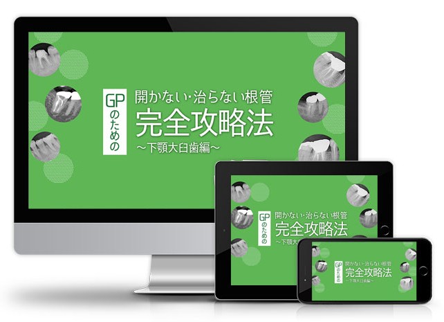 GPのための開かない・治らない根管 完全攻略法～下顎大臼歯編～│医療情報研究所DVD