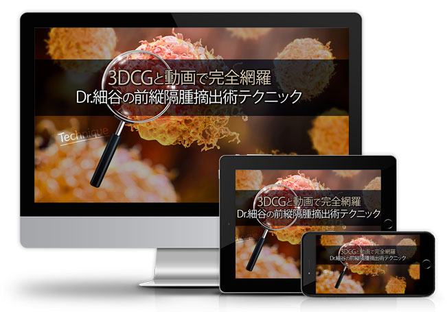 3DCGと動画で完全網羅 Dr.細谷の前縦隔腫摘出術テクニック│医療情報研究所DVD
