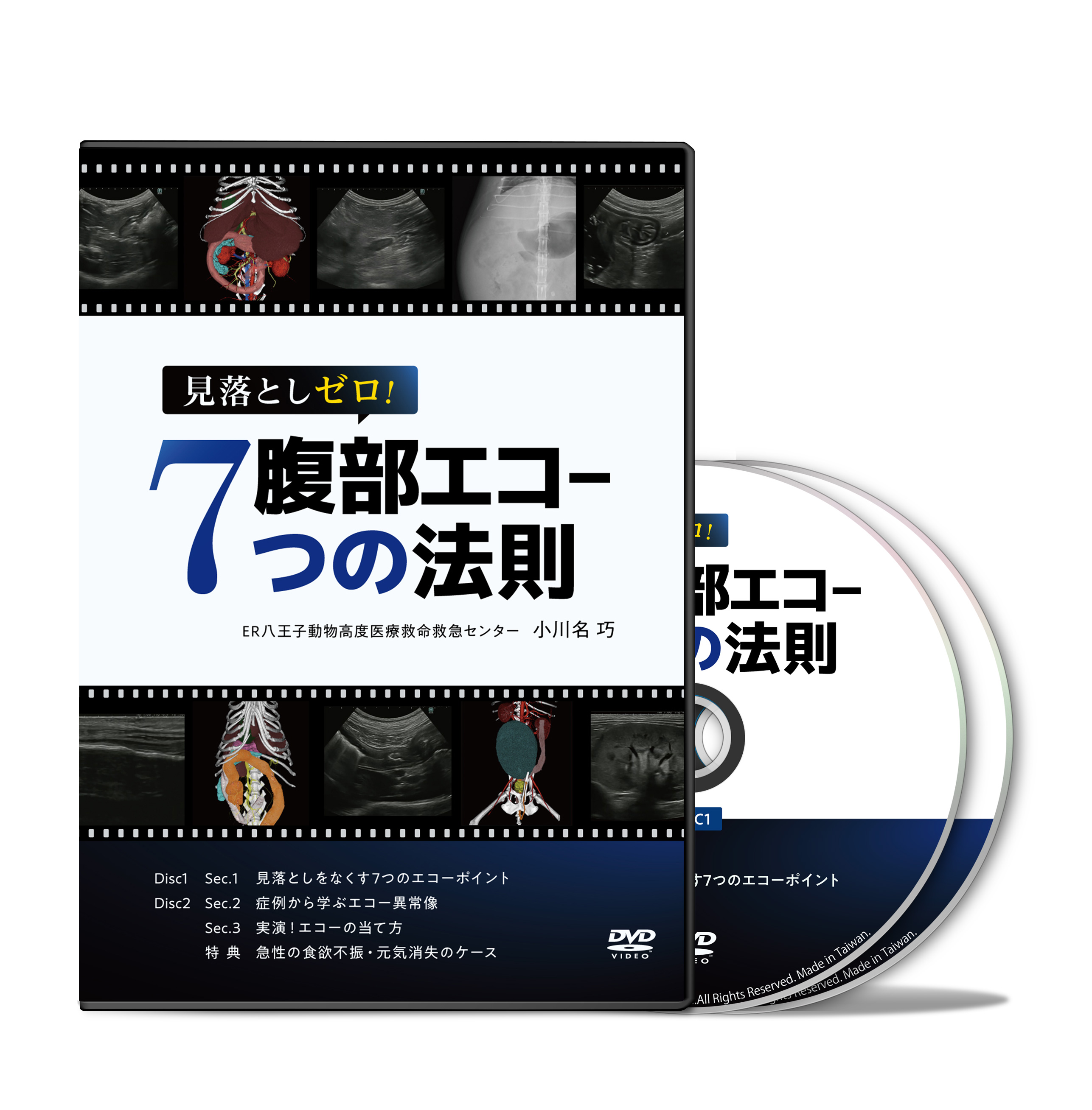 見落としゼロ！腹部エコー７つの法則│医療情報研究所DVD