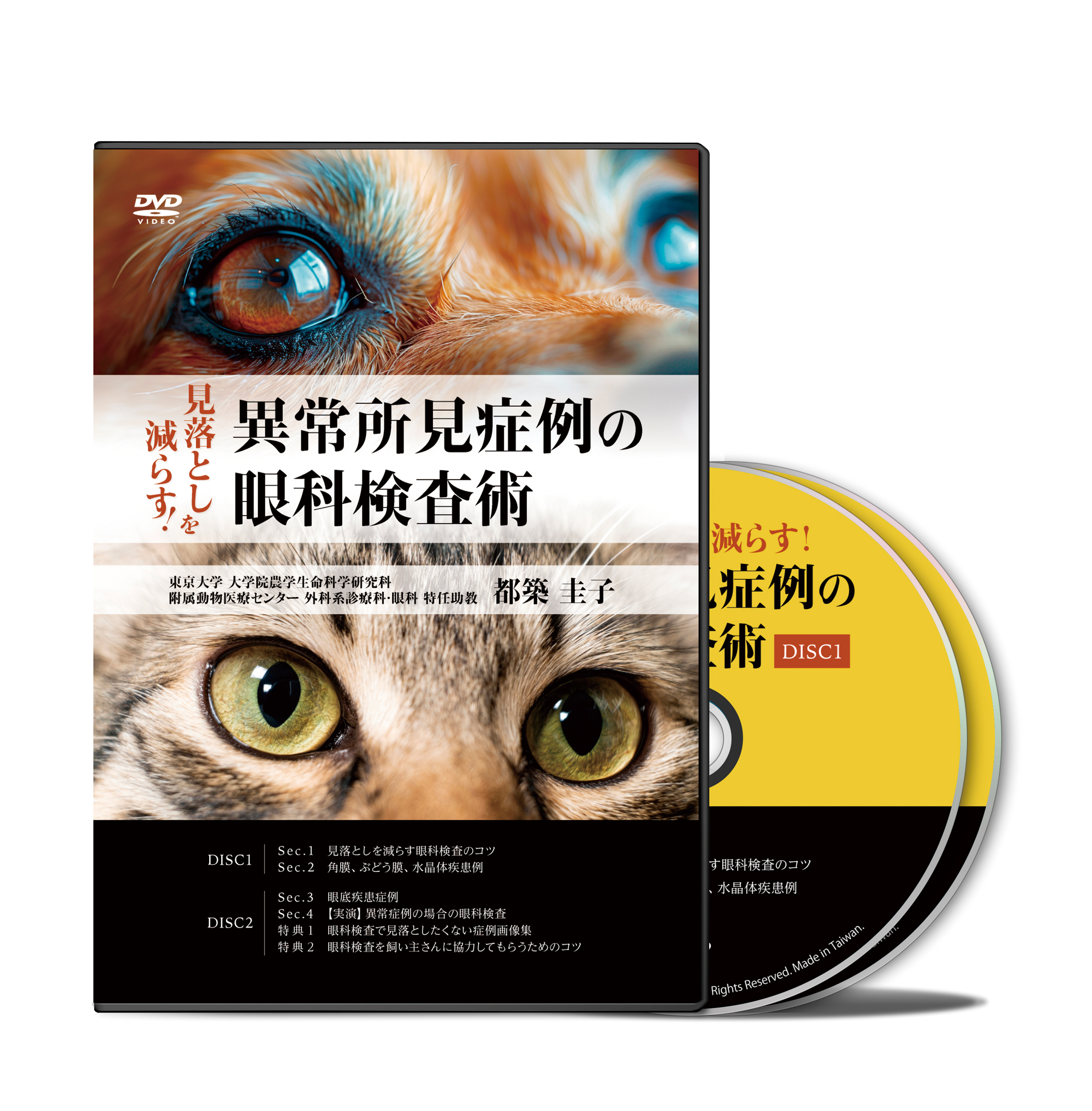 見落としを減らす！異常所見症例の眼科検査術│医療情報研究所DVD